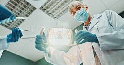 Buy stock photo POV, team and dentist with light for dental procedure, extraction service or periodontal treatment. Dentistry portrait, mature woman and surgical lamp in clinic for root canal, oral checkup and below