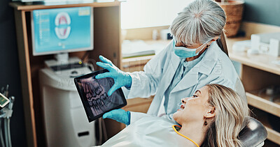 Buy stock photo Patient, consultation and dentist with tablet screen in office, dental health and explain diagnosis. Oral care, teeth exam and medical professional with tech, treatment plan and happy woman in clinic