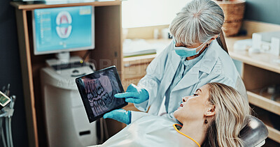 Buy stock photo Patient, appointment and dentist with tablet screen in office, dental health or explaining diagnosis. Oral care, teeth exam and medical professional with tech, treatment plan and women in clinic