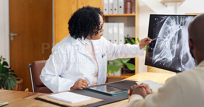 Buy stock photo Doctor, patient and consultation with xray on computer, cancer or lung disease with scan for healthcare. Oncologist, person and CT on screen, surgery or cardiovascular medicine with conversation