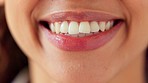 Close up of white teeth and pretty lips of an African female  veneers and after teeth whitening treatment at her medical appointment. Portrait of a healthy young womans mouth smiling and laughing