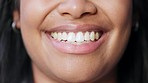 Closeup of smiling dentist showing perfect white teeth with orthodontic invisible braces, teeth whitening treatment or procedure. Headshot of happy woman promoting healthy oral and tooth care routine