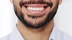 Man smiling with teeth showing after dental medical treatment. The dentist checked his mouth and did great job with his teeth leaving them fresh and clean. Close up portrait of male with toothy smile