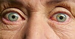 Senior man, blue eyes or surprise face expression with shock, fear or paranoid anxiety. Zoom on portrait, skin or vision for scared retirement elderly in wow blink motion, alarm or panic for bad news