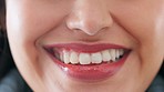 Dental, skin, and healthcare, a woman with teeth, smiling close up. Medical insurance, beauty and lip filler, modern medicine for beautiful smile. Makeup, dentist visit and happy face and lifestyle 