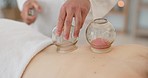 Relax, cupping treatment and back massage at a wellness, healing and beauty spa at resort. Calm, therapy and self care with glass cup vacuum routine by therapist at health, luxury and cosmetic salon.