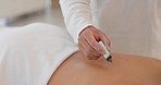 Wellness, medicine and heat acupuncture on back of female client lying on spa bed with therapist for moxibustion or moxa smoke therapy. Spiritual healing, body and stress relief with chinese man