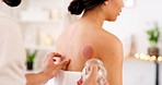 Woman, man or cupping therapy in salon, healthcare clinic or holistic China center for pain relief or muscle tension management. Zoom, physiotherapist and patient with glass suction for back wellness