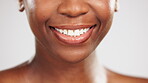 Face, teeth and dental smile of black woman in studio isolated on a gray background. Tooth care, cosmetics and happy female model laughing with invisalign, veneers or lips makeup for skincare beauty.