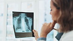 X ray, analysis and woman doctor thinking of healthcare research, solution and review of skeleton, spine problem. Radiology professional, medical worker or female in xray anatomy career contemplating