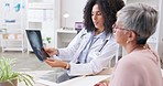 Woman, doctor and senior woman with mri results in a hospital for brain and head injury. Talking, healthcare and medical worker with elderly female patient speaking about surgery and treatment choice