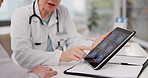 Woman, doctor and hands on tablet with brain scan or patient in medical examination, results or anatomy at clinic. Closeup of healthcare professional consulting customer on technology for xray or MRI