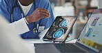 Doctor, hands and tablet with x ray brain scan in meeting, discussion or planning surgery at the hospital. Closeup of medical or healthcare employees explaining MRI or CT of patient on technology 