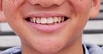 Smile, happy and closeup of mouth of boy in city for happiness, joy and facial expression. Dental care, freckles and face zoom of child for teeth whitening for confidence, pride and oral health
