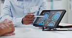 Person, hands and tablet with brain scan for patient, consultation or examination results at hospital. Closeup of doctor, medical employee or nurse pointing to technology for MRI at neurology clinic