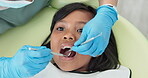 Girl, pediatric dentist and checkup of teeth in chair and family friendly examination for tooth cavities. Child, dental mirror and consultation by orthodontist with trust and exam for caries in mouth