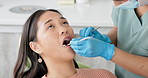 Asian woman, dentist and patient with cleaning tools for mouth, oral or gum in dental care at clinic. Face of female person in relax with orthodontist for tooth whitening, hygiene or removing cavity