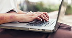 Hands, remote work and business woman on laptop in city with planning, search or writing closeup. Keyboard, communication or freelance writer with computer for networking, typing or article research