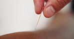 Closeup hand, needle and acupuncture treatment for health, wellness and spiritual or chakra balance. Spa, parlour and alternative healthcare for peace, relaxation and pain or arthritis relief in skin