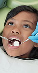 Dentist, hands and girl with mirror to check tooth, growth and oral wellness for service in hospital. Child, dental inspection and tools in mouth with help for gum disease, cavity or health in clinic