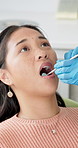 Dental inspection, mouth and woman at dentist for oral checkup, examination or treatment with tools. Wellness, female patient and hands with gloves to prevent tooth decay, gum disease or cavities