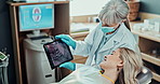 Woman, dentist and appointment in office with tablet, intraoral scan examination on tech. Orthodontist, teeth assessment and healthcare for oral hygiene, medical consultation and dental implant scan