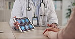 Doctor, tablet screen and hands with people, advice for wellness as neurosurgeon in hospital or clinic. Healthcare professional, help and brain scan in office for diagnosis, results and support