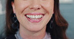 Teeth, lips and closeup of happy woman at dentist for dental care, health and fresh breath. Mouth, tooth whitening and person laughing for oral hygiene, orthodontics and wellness with face cosmetics