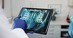 Dentist, consulting and x ray of teeth on tablet for patient education, dental diagnosis and treatment planning. Oral assessment, person and explain with image for hygiene instruction and discussion.