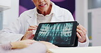 Woman, dentist and tablet screen in healthcare for x ray, teeth diagnosis and plan for treatment. Clinic, patient and dental surgeon with digital for tooth structure, advice and orthodontic procedure