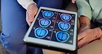 Nurse, senior patient and brain scan on tablet screen for Alzheimers, health and examination in hospital. People, technology and digital MRI results for disease, age related illness and nursing home