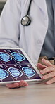 Doctor, hands and tablet with brain scan for patient, consultation or examination results at hospital. Neurologist, closeup and medical advice with person and technology for MRI at neurology clinic