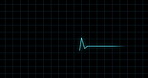 Medical, grid and blue lines in rhythm for monitor, evaluation and assessment of brain wave form or function. Healthcare, pattern and test for research or EEG, neurology and neural activity for study