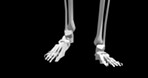 Human body, 3d and skeleton with closeup, walking or medical information, research or biology. Structure, feet or science of anatomy in motion on black background for diagnosis, hologram or bones