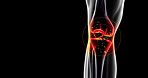 Xray, knee and joint pain with red glow for stem cell therapy, torn meniscus and treatment of radiographic imaging. Leg, skeleton and diagnostic scan for anatomy accident, arthritis or medical injury