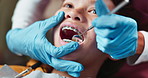 Hands, patient and dental mirror in clinic for mouth examination, treatment process and oral cleaning. Dentist, child and cavity tools with implant procedure, teeth whitening and medical assessment
