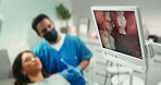 Dental, computer screen and mouth for checkup in clinic with intraoral camera, diagnosis and oral treatment. Dentist, patient and digital for teeth assessment, medical process and braces procedure