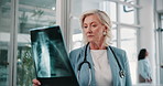 Mature woman, doctor or exam with x ray for CT scan, test or medical results at hospital. Female person, radiologist or healthcare employee checking MRI for anatomy, analysis or examination at clinic