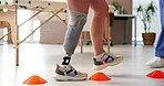 Legs, prosthetic or walking with patient and physiotherapist in office for recovery or rehabilitation. Help, improvement or steps with amputee person and medicine professional in therapy clinic