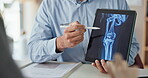 Osteoporosis, doctor and xray with tablet screen and hands for medical, report or treatment. Consultant, medicine or synthetic stem cell therapy with people and bone marrow transplant breakthrough