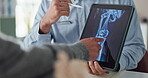 Osteoporosis, consultant and xray with tablet screen and hands for medical, report or treatment. Doctor, medicine or synthetic stem cell therapy with people and bone marrow transplant breakthrough