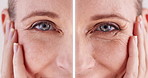 Beauty, eyes and transformation with mature woman closeup in studio for cosmetic skincare treatment. Aging, change or portrait and happy person at salon or spa for before and after dermatology