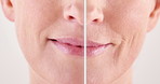 Woman, lips and skincare in studio for comparison, transformation and anti aging treatment. Mature person, change and before and after on white background with results, collagen and retinol benefits