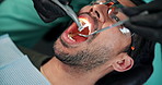 Teeth, hygiene and man with dentist in office for oral cleaning, healthcare and plaque removal. Dental, work and service with equipment in consultation for procedure, appointment or cavity prevention