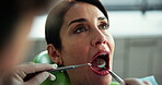 Consulting, teeth and tools with woman at dentist for advice, tooth cleaning and healthcare. Orthodontics, medical and dental implant with person in clinic for patient exam, gum care and mouth
