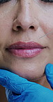 Beauty, woman and hands with filler injection for lips transformation, anti aging treatment or skincare. Mature person, gloves and needle closeup for collagen implant, cosmetic aesthetics or facelift