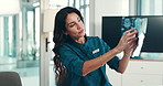 Woman, doctors and group with x ray for brain scan, discussion or problem solving in hospital boardroom. Person, surgeon and screen for mri results, review or talk with medical research for neurology