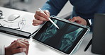 Hands, tablet and doctor with x ray, knees and consulting with results for patient at hospital. People, medical review and radiology scan for legs, bones and injury with consultation at clinic