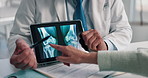 Doctor, hands and tablet for x ray with knee, bones and osteoporosis with point at hospital. People, touchscreen and medical consultation for arthritis, feedback and report for wellness at clinic