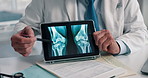 Doctor, hands and tablet for x ray with screen, knee and osteoporosis with point at hospital. People, application and medical consultation for arthritis, feedback and report for wellness at clinic
